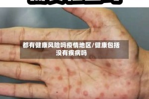 都有健康风险吗疫情地区/健康包括没有疾病吗