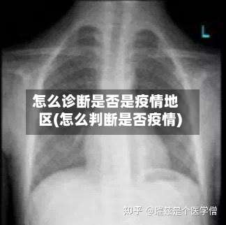 怎么诊断是否是疫情地区(怎么判断是否疫情)-第2张图片